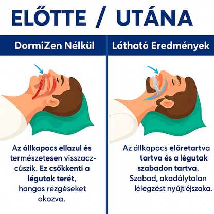 DormiZen® – Horkolásgátló állkapocssín